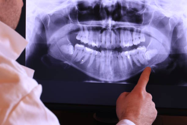 Best Emergency Tooth Extraction in Olivia, MN