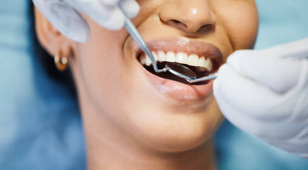 Best Emergency Tooth Extraction in Olivia, MN